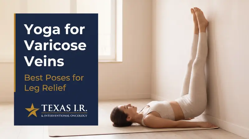 Yoga for Varicose Veins: Best Poses for Relief