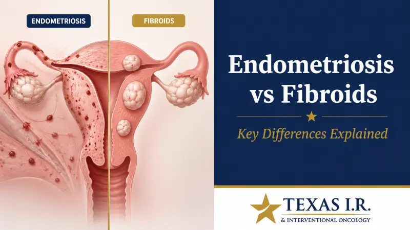 Endometriosis vs Fibroids: How They Differ